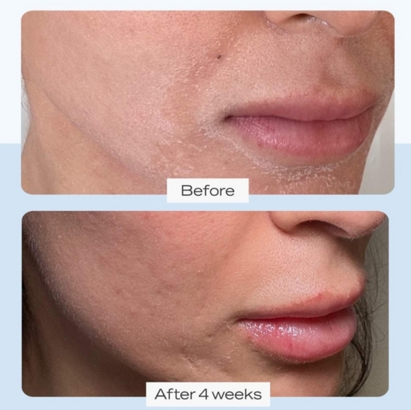🆕️First Aid Beauty Ultra Repair Cream Intense Hydration Skin Protectant (14 oz) - Picture 11 of 11
